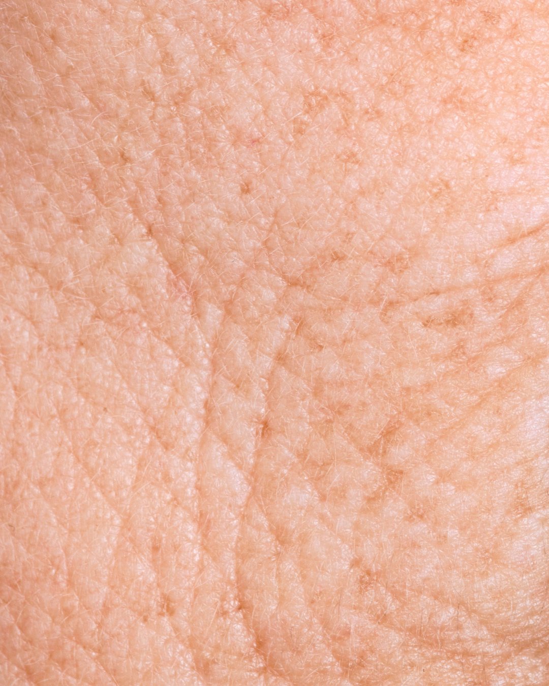 Anti-Aging